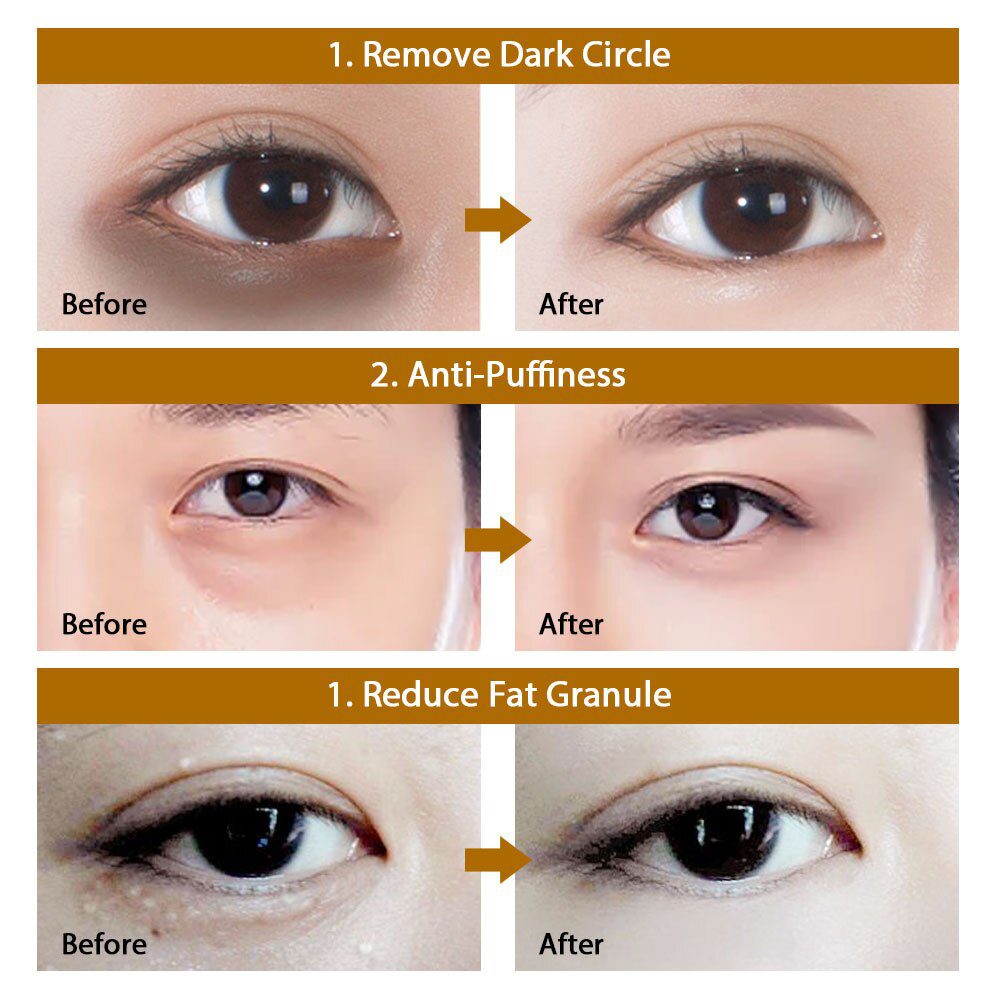 60pcs Hyaluronic Acid Repair Eye Patches Remove Dark Circles Moisturizing Eye Mask Crystal Collagen Gel Mask Eye Skin Care 60pcs Hyaluronic Acid Repair Eye Patches Remove Dark Circles Moisturizing Eye Mask Crystal Collagen Gel Mask Eye Skin Care