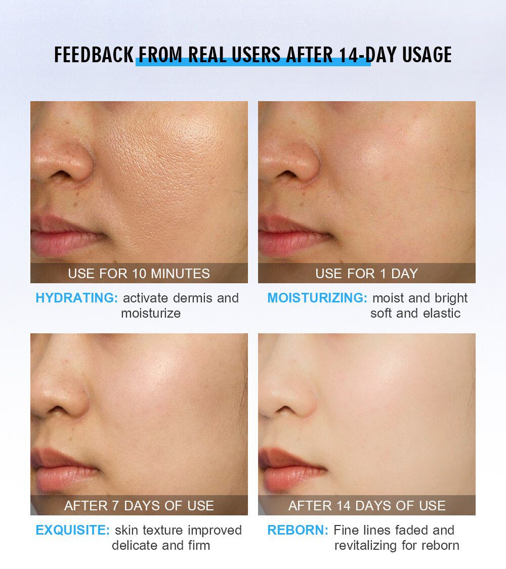 VENZEN Hyaluronic Acid Moisturizing Face Serum Shrink Pores Remove Fine Lines Anti-Aging Anti-Wrinkle Plant Cream Skin Care 15ML VENZEN Hyaluronic Acid Moisturizing Face Serum Shrink Pores Remove Fine Lines Anti-Aging Anti-Wrinkle Plant Cream Skin Care 15ML