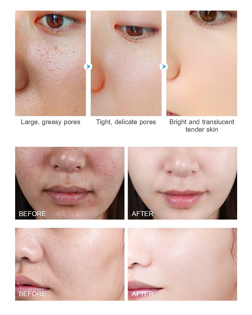 VENZEN Hyaluronic Acid Moisturizing Face Serum Shrink Pores Remove Fine Lines Anti-Aging Anti-Wrinkle Plant Cream Skin Care 15ML VENZEN Hyaluronic Acid Moisturizing Face Serum Shrink Pores Remove Fine Lines Anti-Aging Anti-Wrinkle Plant Cream Skin Care 15ML