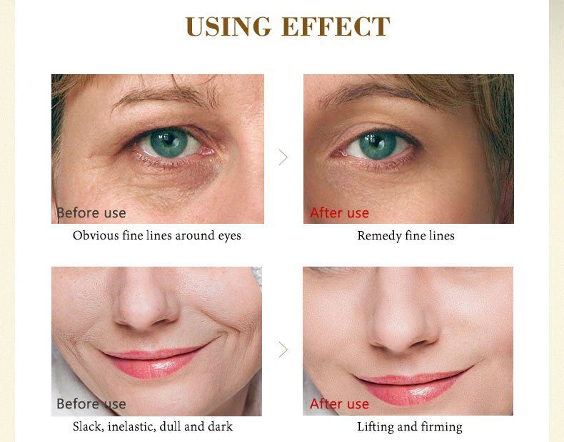 ARTISCARE Nicotinamide + Platinum + 24k Gold Six Peptides Essence 3pcs/lot Anti Wrinkles & Whitening Serum for Face Care Cream ARTISCARE Nicotinamide + Platinum + 24k Gold Six Peptides Essence 3pcs/lot Anti Wrinkles & Whitening Serum for Face Care Cream