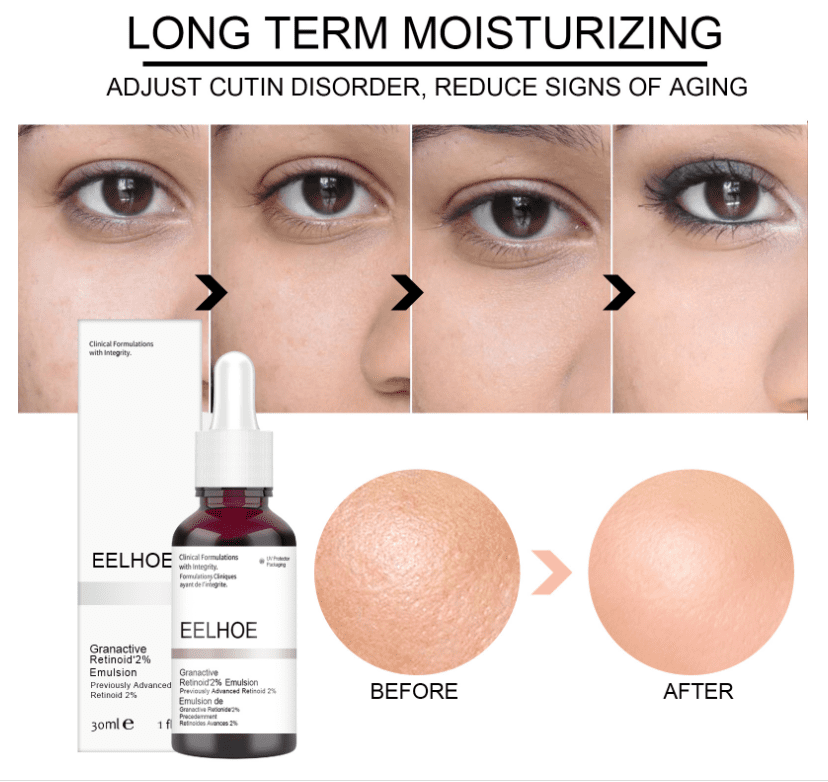 Salicylic Acid Shrink Pores Serum Fruit Acid Exfoliating Moisturizing Nourish Smooth Pores Repair Essence Products Skin Care Salicylic Acid Shrink Pores Serum Fruit Acid Exfoliating Moisturizing Nourish Smooth Pores Repair Essence Products Skin Care