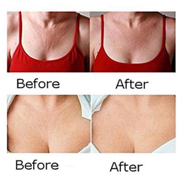 Reusable Anti Wrinkle Neck Pad Silicon Transparent Anti Microgroove Removal Neck Sticker Skin Care Silica Gel Patch Facial Care Reusable Anti Wrinkle Neck Pad Silicon Transparent Anti Microgroove Removal Neck Sticker Skin Care Silica Gel Patch Facial Care