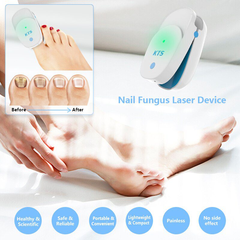 Fungal Nail Treatment Laser Device For Nail Fungus 905nm 470nm Fungus Nail Removal Anti Infection Paronychia Onychomycosis Care Fungal Nail Treatment Laser Device For Nail Fungus 905nm 470nm Fungus Nail Removal Anti Infection Paronychia Onychomycosis Care