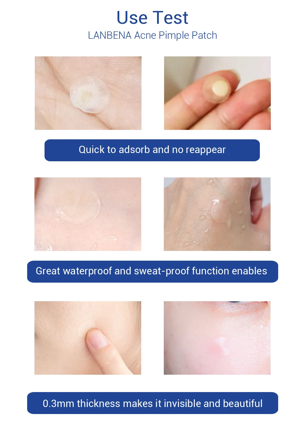 LANBENA Invisible Acne Pimple Patch Face Mask Acne Pimple Blemish Removal Stickers Acne Treatment Master Daily / Night Use LANBENA Invisible Acne Pimple Patch Face Mask Acne Pimple Blemish Removal Stickers Acne Treatment Master Daily / Night Use