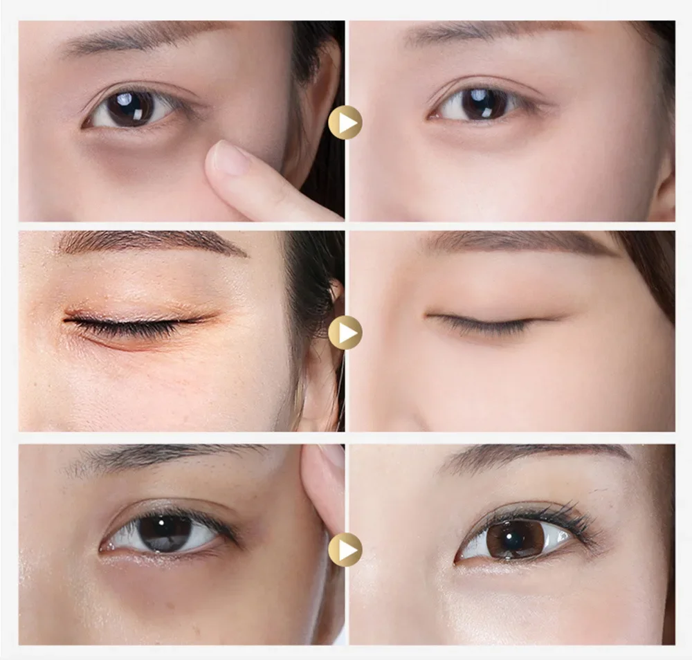 LANBENA Collagen Eye Patch Moisturizing Anti-aging Dark Circle Facial Mask Vitamin C Hyaluronic Retinol Eye Mask 60 Patches LANBENA Collagen Eye Patch Moisturizing Anti-aging Dark Circle Facial Mask Vitamin C Hyaluronic Retinol Eye Mask 60 Patches