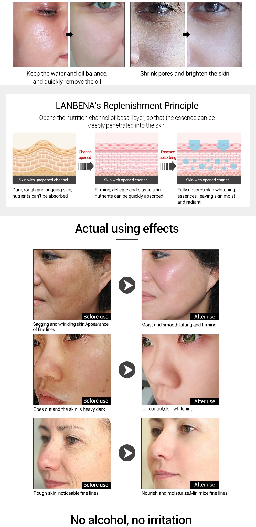 LANBENA Hyaluronic Acid Serum Snail Essence Face Cream Moisturizing Acne Treatment Repair Whitening Anti-Aning Winkles10PCS LANBENA Hyaluronic Acid Serum Snail Essence Face Cream Moisturizing Acne Treatment Repair Whitening Anti-Aning Winkles10PCS