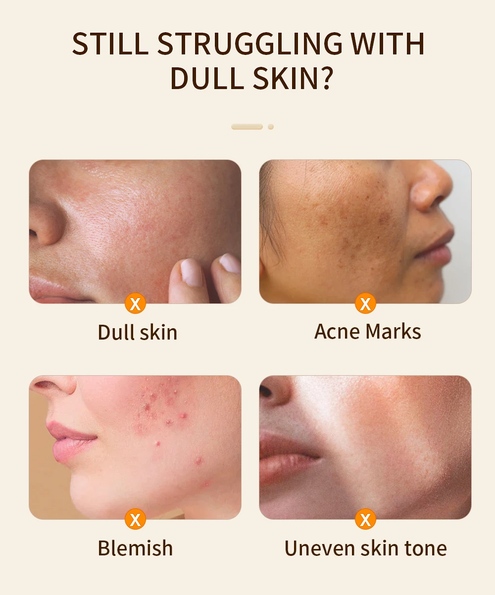 LANBENA Antioxidant Vitamin C Quercetin Ascorbic Acid Serum Reduces Dull Brightening Complexion Soothing Facial Care 15/30ml LANBENA Antioxidant Vitamin C Quercetin Ascorbic Acid Serum Reduces Dull Brightening Complexion Soothing Facial Care 15/30ml