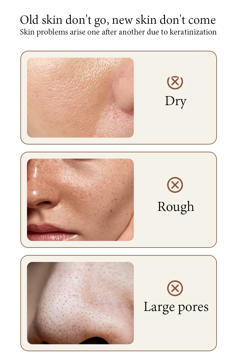 BIOAQUA White Rice Face Exfoliating Gel Moisturizing Nourishing skincare Facial Scrub Face Cream Facial Exfoliants Skin Care BIOAQUA White Rice Face Exfoliating Gel Moisturizing Nourishing skincare Facial Scrub Face Cream Facial Exfoliants Skin Care