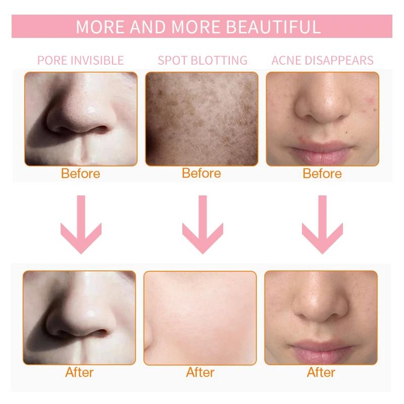 Led Face and Neck Mask Beauty Electric Face Mask for Woman Man 7 Colors Light LED Mask Facial Skin Care Repair Skin Whitening Led Face and Neck Mask Beauty Electric Face Mask for Woman Man 7 Colors Light LED Mask Facial Skin Care Repair Skin Whitening