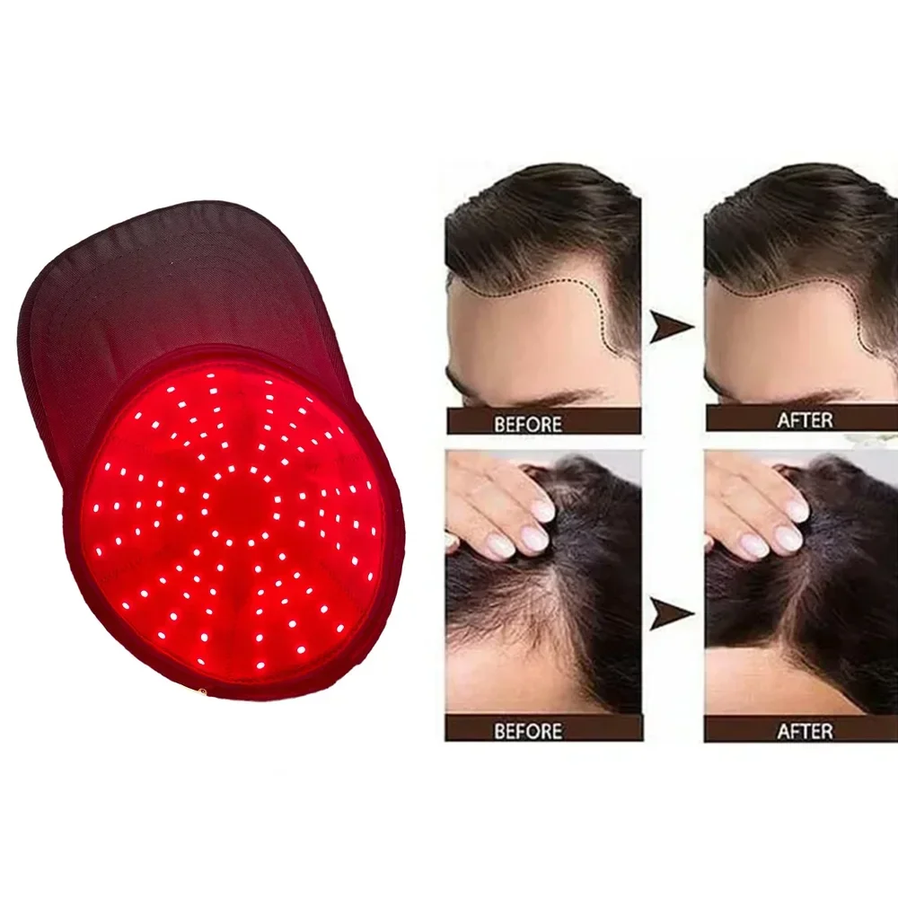 New 96Pcs Infrared LEDs 660nm&850nm Red Light Therapy Hair Growth Cap for Hair Regrowth Anti Hair Loss Relax Scalp Hair Care Hat