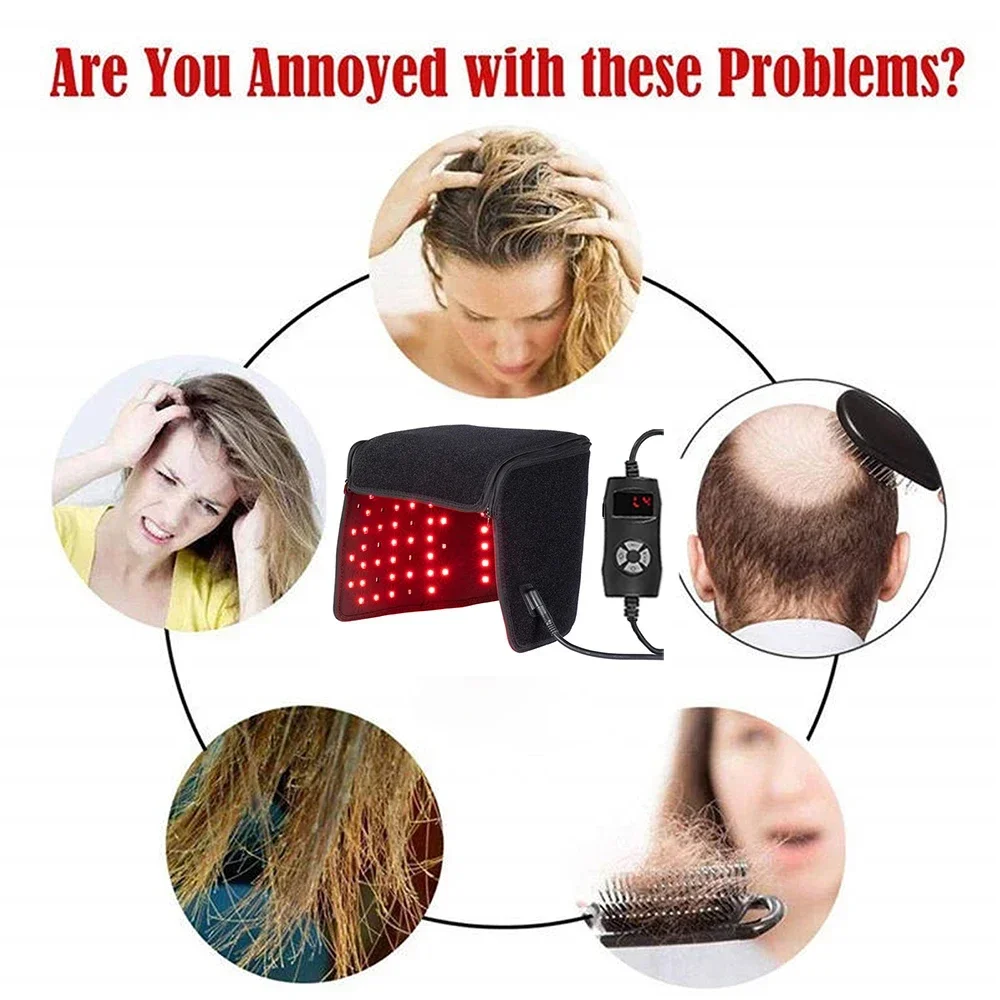 LED Red Light Therapy Hat For Hair Growth 215 Bead Lights Anti Hair Loss LED 650nm Light Treatment Laser Helmet For Hair Growth